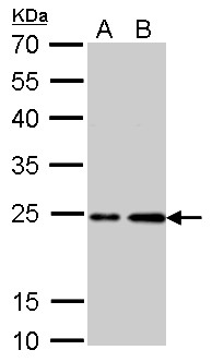 HRAS / H-Ras Antibody - H-Ras antibody detects HRAS protein by Western blot analysis. A. 30 ug PC-12 whole cell lysate/extract. B. 30 ug Rat2 whole cell lysate/extract. 12 % SDS-PAGE. H-Ras antibody dilution:1:1000
