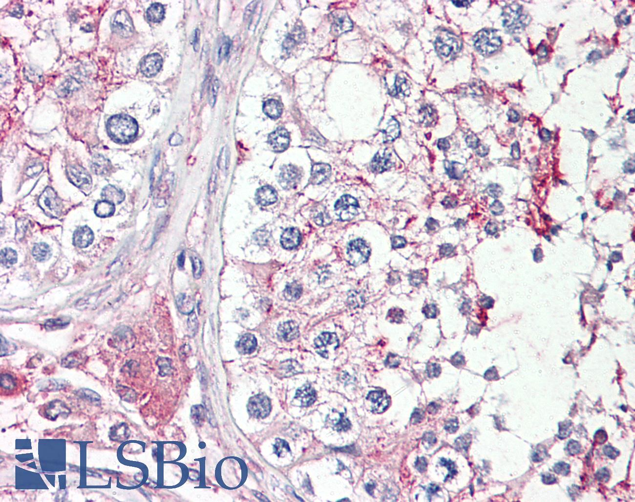 HRASLS1 / HRASLS Antibody - Anti-HRASLS antibody IHC of human testis. Immunohistochemistry of formalin-fixed, paraffin-embedded tissue after heat-induced antigen retrieval. Antibody concentration 3.75 ug/ml.