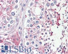 HRASLS1 / HRASLS Antibody - Anti-HRASLS antibody IHC of human testis. Immunohistochemistry of formalin-fixed, paraffin-embedded tissue after heat-induced antigen retrieval. Antibody concentration 3.75 ug/ml.