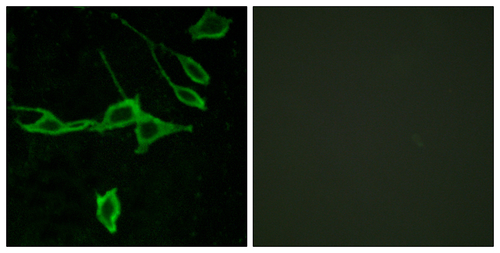 HRH1 / Histamine H1 Receptor Antibody - Immunofluorescence analysis of LOVO cells, using HRH1 Antibody. The picture on the right is blocked with the synthesized peptide.