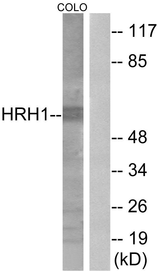 HRH1 / Histamine H1 Receptor Antibody - Western blot analysis of lysates from COLO205 cells, using HRH1 Antibody. The lane on the right is blocked with the synthesized peptide.