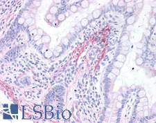 HRH2 / Histamine H2 Receptor Antibody - Human Small Intestine: Formalin-Fixed, Paraffin-Embedded (FFPE)