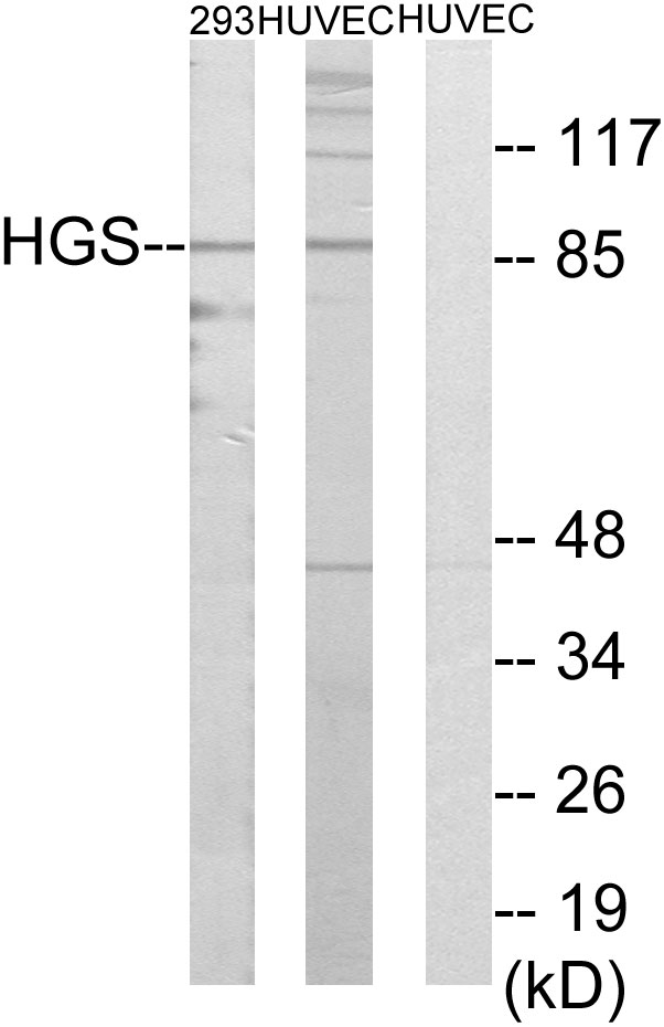 HRS / HGS Antibody - Western blot analysis of lysates from 293 and HUVEC cells, using HGS Antibody. The lane on the right is blocked with the synthesized peptide.