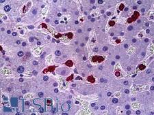 HRS / HGS Antibody - Anti-HGS antibody IHC of human liver. Immunohistochemistry of formalin-fixed, paraffin-embedded tissue after heat-induced antigen retrieval. Antibody dilution 1:100.