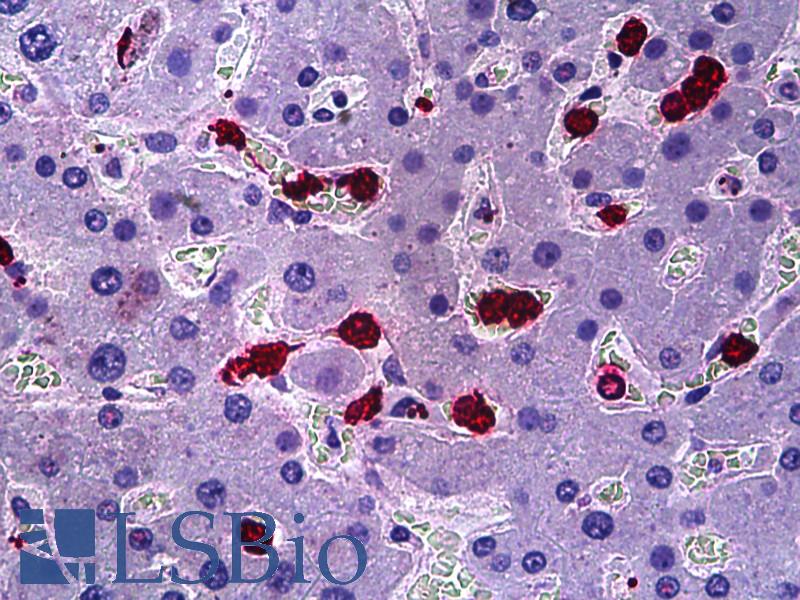 HRS / HGS Antibody - Anti-HGS antibody IHC of human liver. Immunohistochemistry of formalin-fixed, paraffin-embedded tissue after heat-induced antigen retrieval. Antibody dilution 1:100.