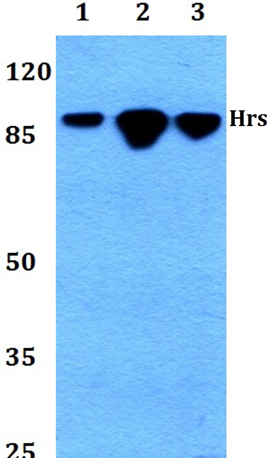 HRS / HGS Antibody - Western blot analysis of HRS pAb at 1:500 dilution. Lane 1: HEK293T whole cell lysate. Lane 2: Raw264.7 whole cell lysate. Lane 3: H9C2 whole cell lysate.