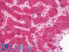 HSD11B1 / HSD11B Antibody - Human Liver: Formalin-Fixed, Paraffin-Embedded (FFPE)