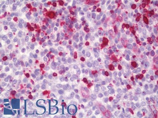 HSD11B1 / HSD11B Antibody - Human Spleen: Formalin-Fixed, Paraffin-Embedded (FFPE)