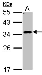 HSD11B1 / HSD11B Antibody - Sample (30 ug of whole cell lysate). A: Hep G2 . 12% SDS PAGE. HSD11B1 antibody diluted at 1:1000.