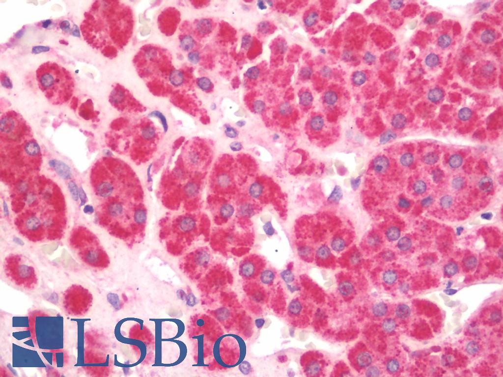 HSD11B1 / HSD11B Antibody - Anti-HSD11B1 / HSD11B antibody IHC staining of human adrenal. Immunohistochemistry of formalin-fixed, paraffin-embedded tissue after heat-induced antigen retrieval.