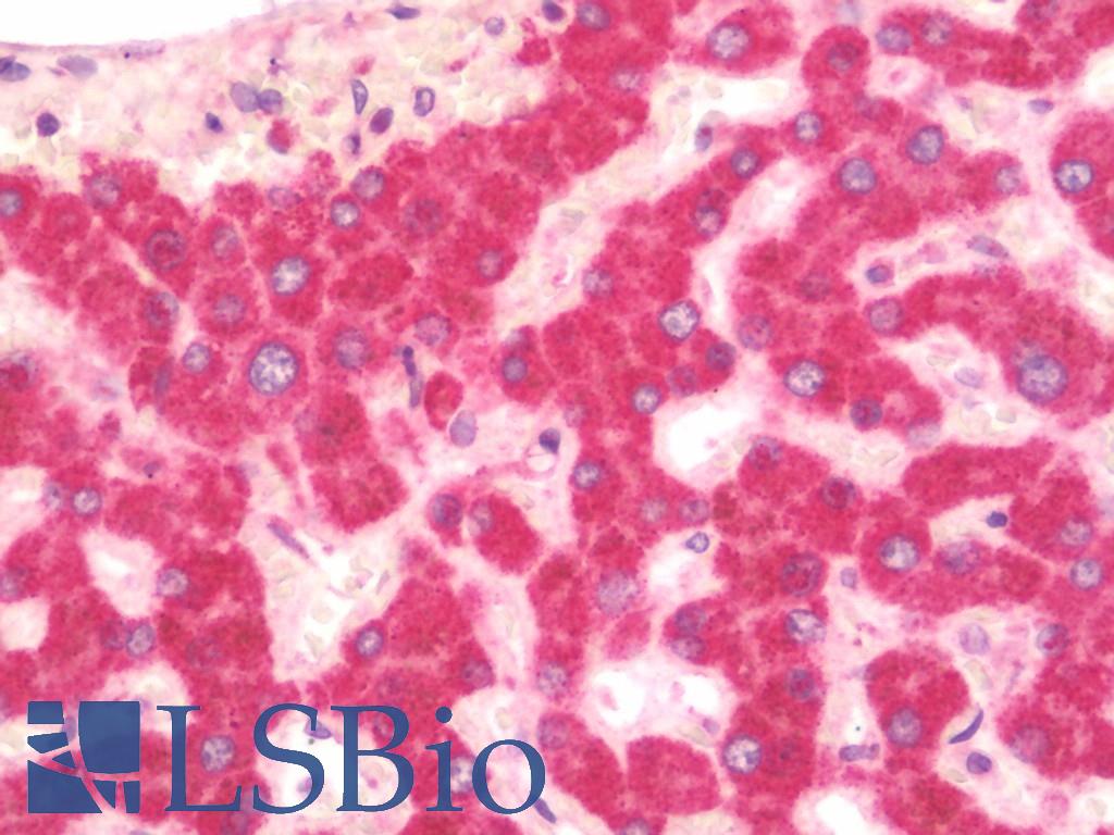 HSD11B1 / HSD11B Antibody - Anti-HSD11B1 / HSD11B antibody IHC staining of human liver. Immunohistochemistry of formalin-fixed, paraffin-embedded tissue after heat-induced antigen retrieval.