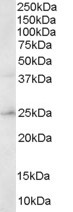 HSD17B10 / HADH2 Antibody - Staining (0.3 ug/ml) of Human Brain lysate (RIPA buffer, 30 ug total protein per lane). Primary incubated for 1 hour. Detected by chemiluminescence.