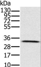 HSD17B8 / RING2 Antibody - Western blot analysis of Human testis tissue, using HSD17B8 Polyclonal Antibody at dilution of 1:650.