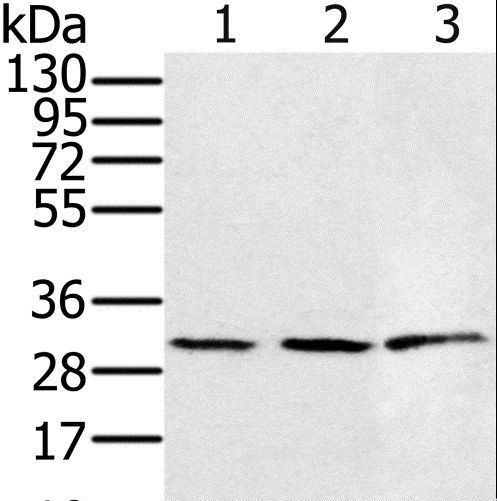 HSD17B8 / RING2 Antibody - Western blot analysis of 293T and K562 cell, human fetal liver tissue, using HSD17B8 Polyclonal Antibody at dilution of 1:450.
