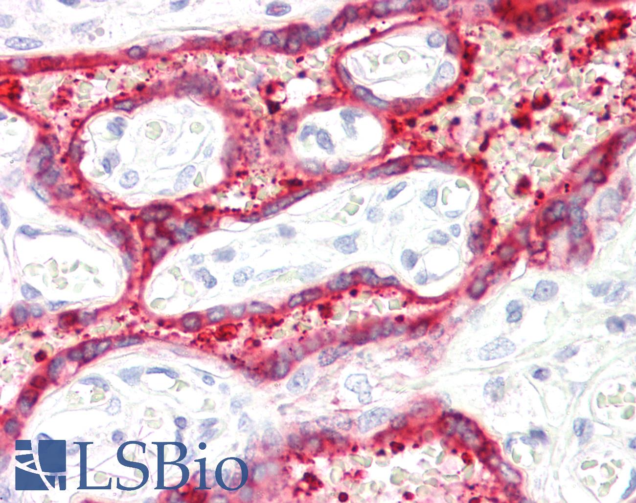 HSD3B1 Antibody - Anti-HSD3B1 antibody IHC staining of human placenta. Immunohistochemistry of formalin-fixed, paraffin-embedded tissue after heat-induced antigen retrieval.