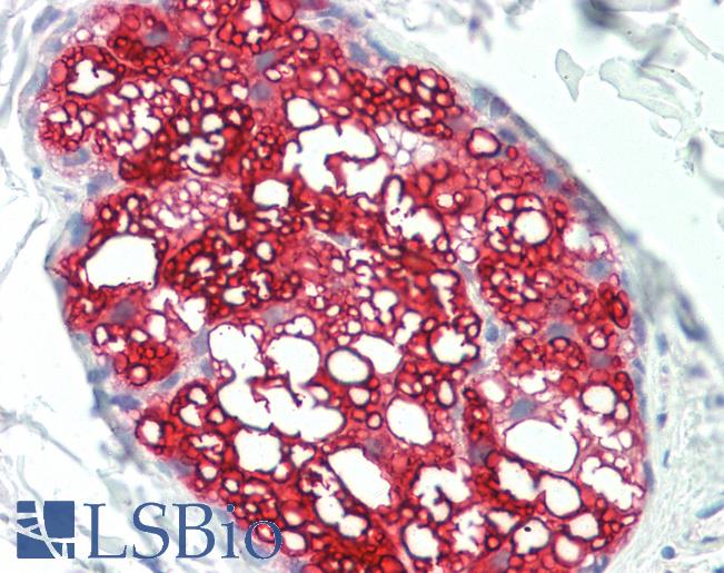 HSD3B1 Antibody - Anti-HSD3B1 antibody IHC staining of human skin, sebaceous gland. Immunohistochemistry of formalin-fixed, paraffin-embedded tissue after heat-induced antigen retrieval.