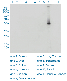 HSD3B1 Antibody - HSD3B1 monoclonal antibody (M01), clone 3C11-D4. Western blot of HSD3B1 expression in human placenta.