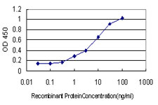 HSET / KIFC1 Antibody - Detection limit for recombinant GST tagged KIFC1 is approximately 1 ng/ml as a capture antibody.