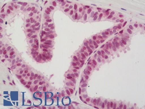 HSF1 Antibody - Human Prostate: Formalin-Fixed, Paraffin-Embedded (FFPE)