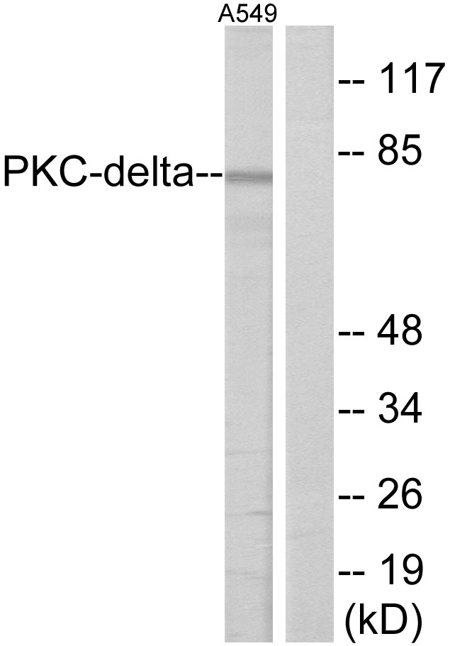 HSF1 Antibody - Western blot analysis of lysates from A549 cells, treated with TNF-Î± 20ng/ml 30', using HSF1 Antibody. The lane on the right is blocked with the synthesized peptide.