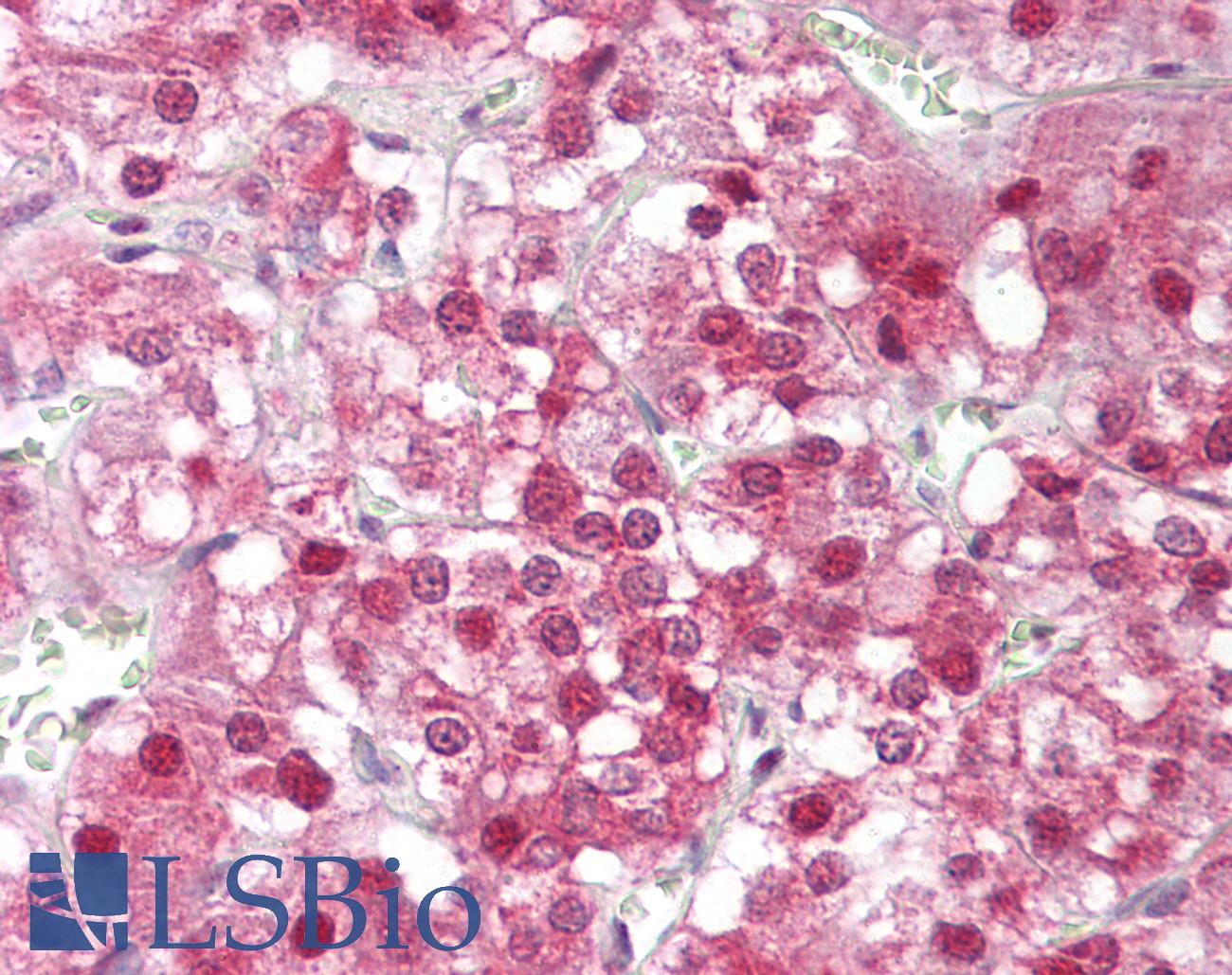 HSF1 Antibody - Anti-HSF1 antibody IHC of human adrenal. Immunohistochemistry of formalin-fixed, paraffin-embedded tissue after heat-induced antigen retrieval. Antibody dilution 1:100.
