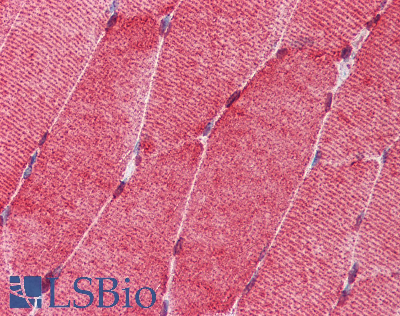 HSF1 Antibody - Anti-HSF1 antibody IHC of human skeletal muscle. Immunohistochemistry of formalin-fixed, paraffin-embedded tissue after heat-induced antigen retrieval. Antibody concentration 10 ug/ml.