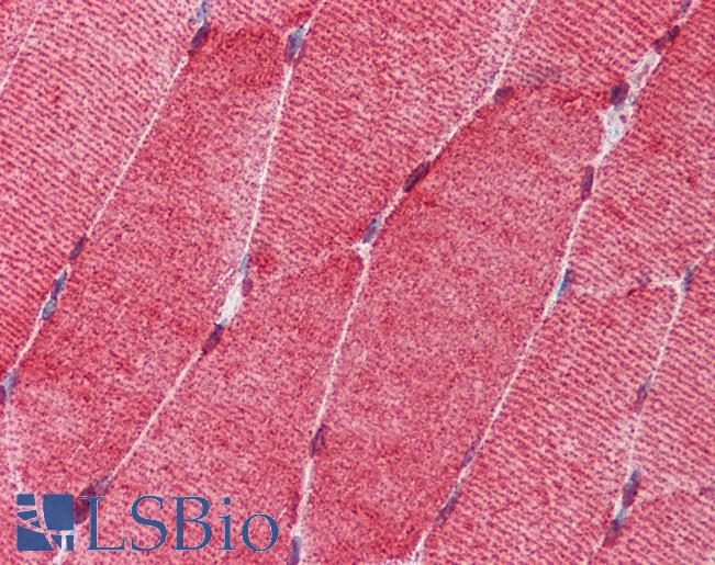HSF1 Antibody - Anti-HSF1 antibody IHC of human skeletal muscle. Immunohistochemistry of formalin-fixed, paraffin-embedded tissue after heat-induced antigen retrieval. Antibody concentration 10 ug/ml.