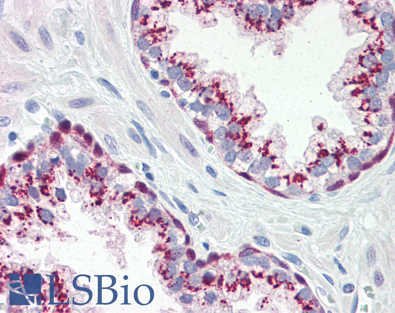 HSP70 / Heat Shock Protein 70 Antibody - Anti-HSP70 / Heat Shock Protein 70 antibody IHC of human prostate. Immunohistochemistry of formalin-fixed, paraffin-embedded tissue after heat-induced antigen retrieval. Antibody concentration 10 ug/ml.