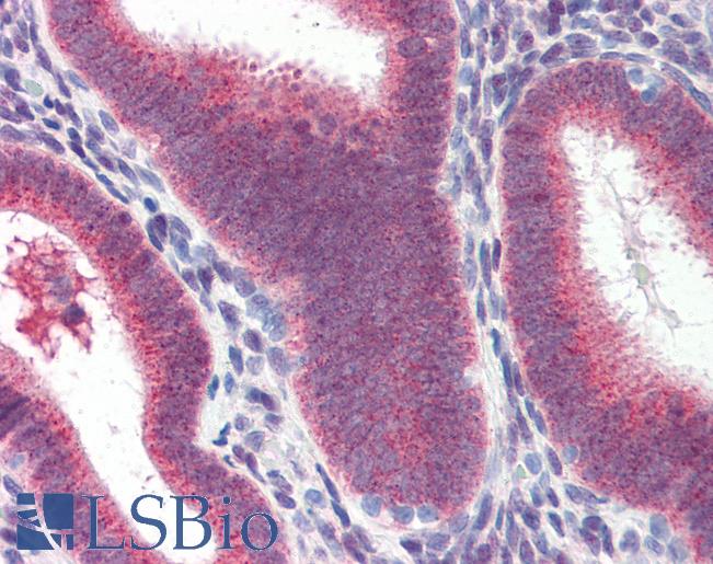 HSP70 / Heat Shock Protein 70 Antibody - Anti-HSP70 / Heat Shock Protein 70 antibody IHC of human uterus. Immunohistochemistry of formalin-fixed, paraffin-embedded tissue after heat-induced antigen retrieval. Antibody concentration 10 ug/ml.