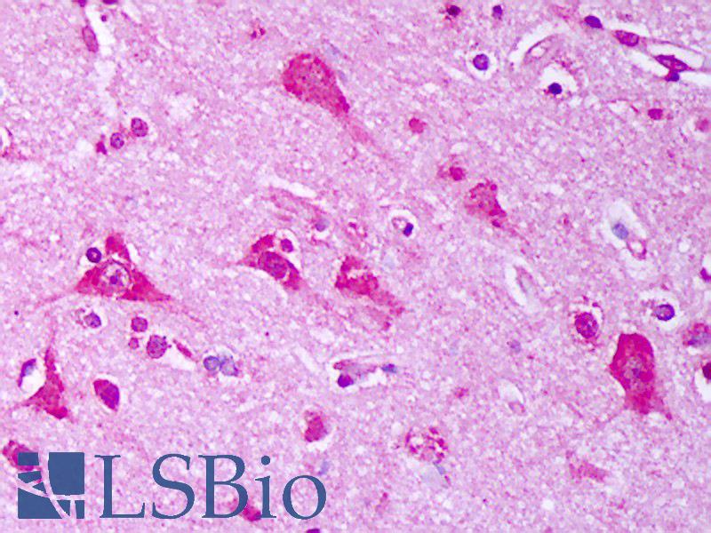 HSP70 / Heat Shock Protein 70 Antibody - Anti-HSP70 / Heat Shock Protein 70 antibody IHC of human brain, cortex neurons. Immunohistochemistry of formalin-fixed, paraffin-embedded tissue after heat-induced antigen retrieval. Antibody concentration 10 ug/ml.  This image was taken for the unconjugated form of this product. Other forms have not been tested.