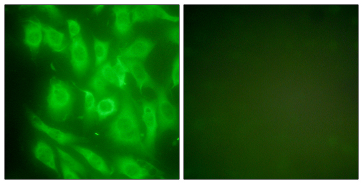 HSP90AA1 / Hsp90 Alpha A1 Antibody - Immunofluorescence analysis of NIH/3T3 cells, using HSP90A Antibody. The picture on the right is blocked with the synthesized peptide.