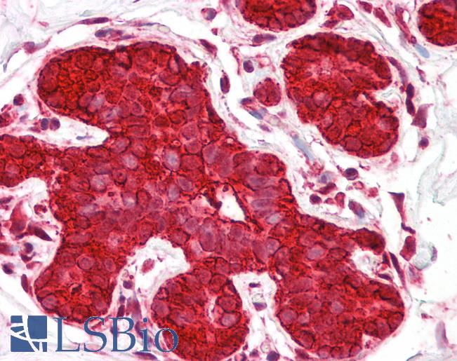 HSP90AA1 / Hsp90 Alpha A1 Antibody - Anti-HSP90AA1 / Hsp90 antibody IHC of human breast. Immunohistochemistry of formalin-fixed, paraffin-embedded tissue after heat-induced antigen retrieval. Antibody dilution 1:100.