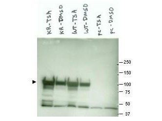 HSP90AA1 / Hsp90 Alpha A1 Antibody - Anti-Hsp90 Antibody - Western Blot. Western blot of Affinity Purified anti-Hsp90 antibody shows detection of a band at ~90 kD corresponding to Hsp90 in various lysate preparations (arrowhead). Cos7 transfected with mutant K294R Hsp90 (left two lanes), Cos7 transfected with wild type Hsp90 (middle two lanes) and empty vector Cos7 cells (right two lanes) were either treated with Trichostatin A (an HDAC inhibitor) or mock treated with DMSO only, as indicated. Transfected cells express either mutant or wt Hsp90 coupled to FlagTM tag. Anti-FlagTM immunoprecipitation was performed prior to western blotting with anti-Hsp90. Personal Communication, Brad Scroggins, Urologic Oncology Branch, CCR, NCI, Rockville, MD.