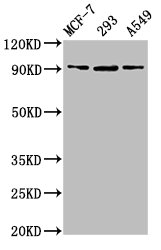 HSP90B1 / GP96 / GRP94 Antibody - Western Blot Positive WB detected in: MCF-7 whole cell lysate, 293 whole cell lysate, A549 whole cell lysate All lanes: HSP90B1 antibody at 6.3µg/ml Secondary Goat polyclonal to rabbit IgG at 1/50000 dilution Predicted band size: 93 kDa Observed band size: 93 kDa