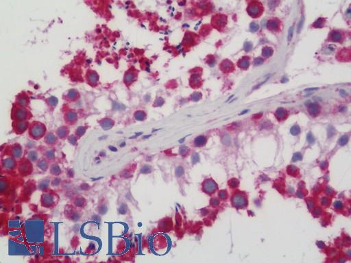 HSP90B1 / GP96 / GRP94 Antibody - Human Testis: Formalin-Fixed, Paraffin-Embedded (FFPE)