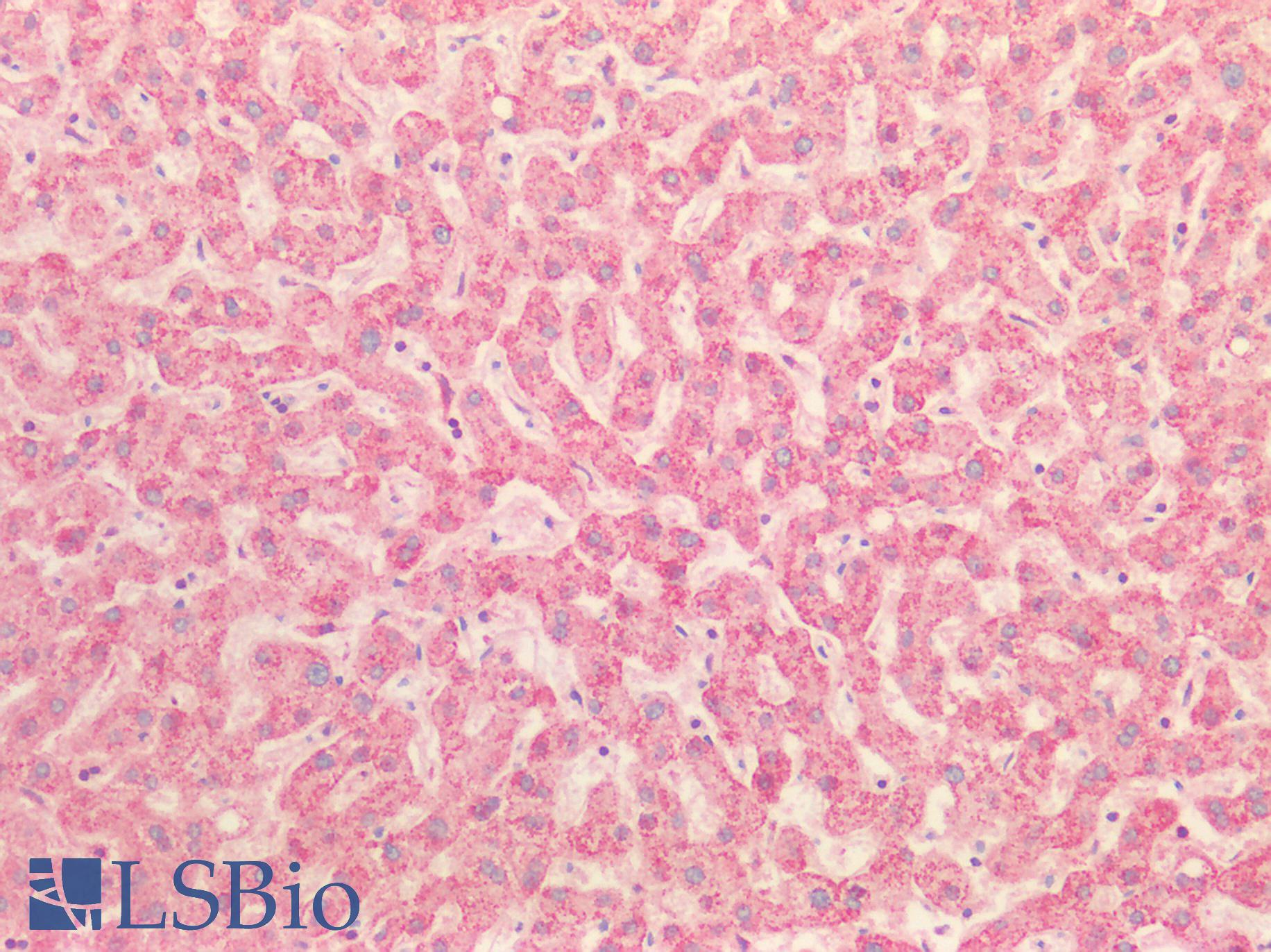 HSP90B1 / GP96 / GRP94 Antibody - Human Liver: Formalin-Fixed, Paraffin-Embedded (FFPE)