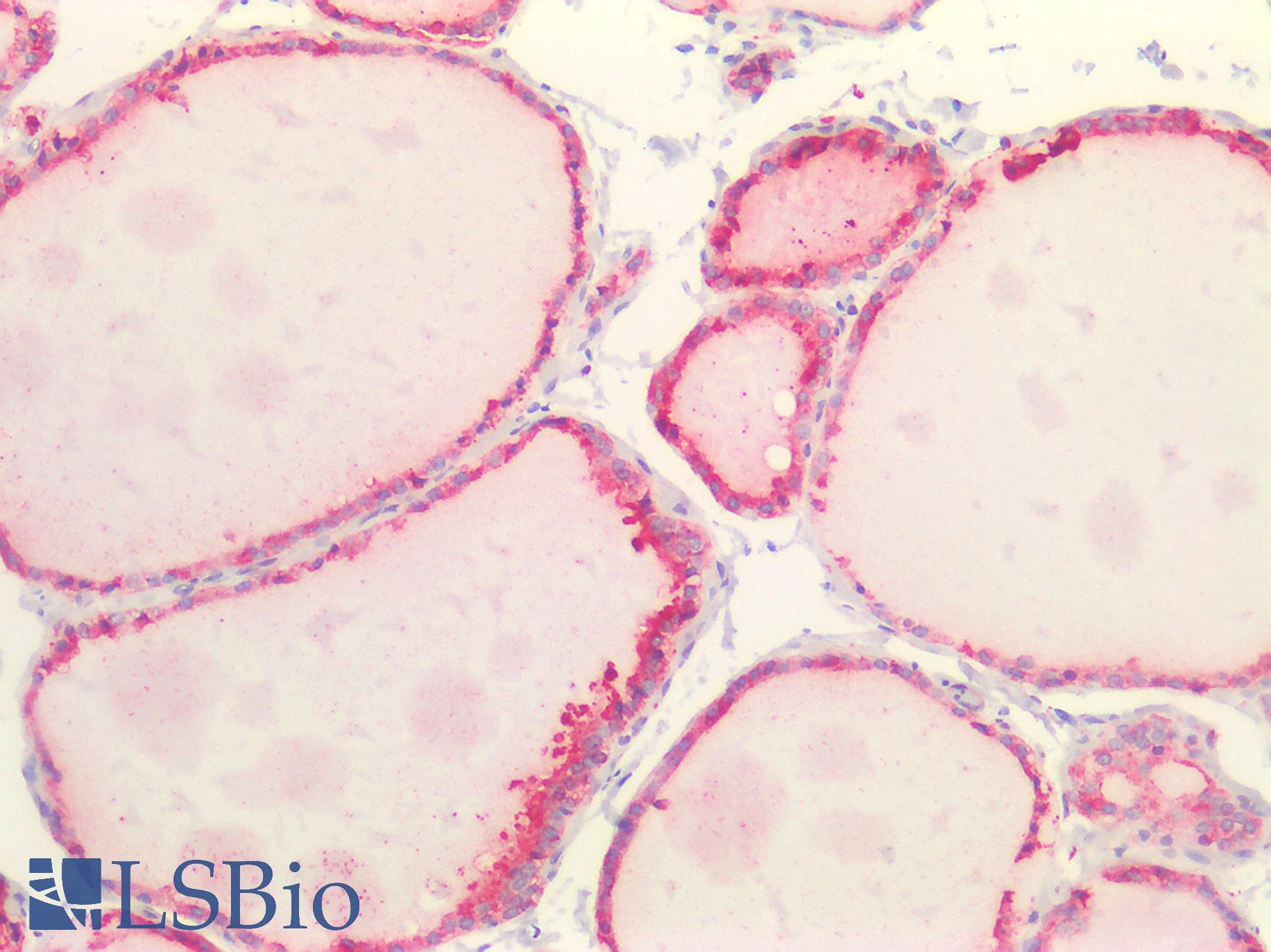 HSP90B1 / GP96 / GRP94 Antibody - Human Thyroid: Formalin-Fixed, Paraffin-Embedded (FFPE)