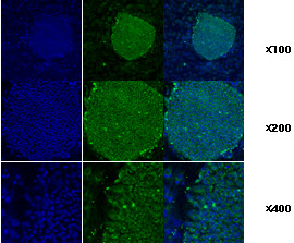 HSP90B1 / GP96 / GRP94 Antibody - Immunofluorescence staining of human ES cell colony with monoclonal anti-human TRA1 antibody (2H3).