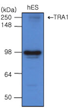 HSP90B1 / GP96 / GRP94 Antibody - The cell lysates of hES(20 ug) were resolved by SDS-PAGE, transferred to PVDF membrane and probed with anti-human TRA 1 (1:500). Proteins were visualized using a goat anti-mouse secondary antibody conjugated to HRP and an ECL detection system.