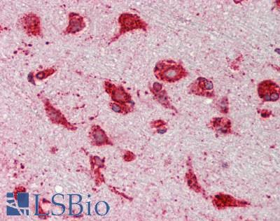 HSP90B1 / GP96 / GRP94 Antibody - Human Brain, Cortex: Formalin-Fixed, Paraffin-Embedded (FFPE)