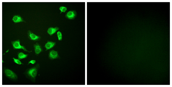 HSP90B1 / GP96 / GRP94 Antibody - Immunofluorescence analysis of HepG2 cells, using GRP94 Antibody. The picture on the right is blocked with the synthesized peptide.