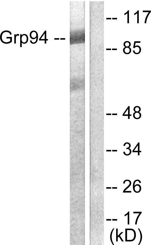 HSP90B1 / GP96 / GRP94 Antibody - Western blot analysis of lysates from SKOV3 cells, using GRP94 Antibody. The lane on the right is blocked with the synthesized peptide.
