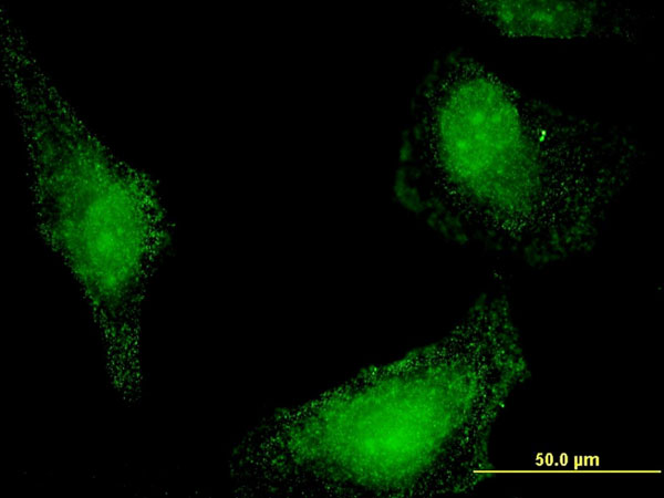 HSPA13 Antibody - Immunofluorescence of monoclonal antibody to HSPA13 on HeLa cell . [antibody concentration 10 ug/ml]