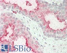 HSPA13 Antibody - Human Prostate: Formalin-Fixed, Paraffin-Embedded (FFPE)