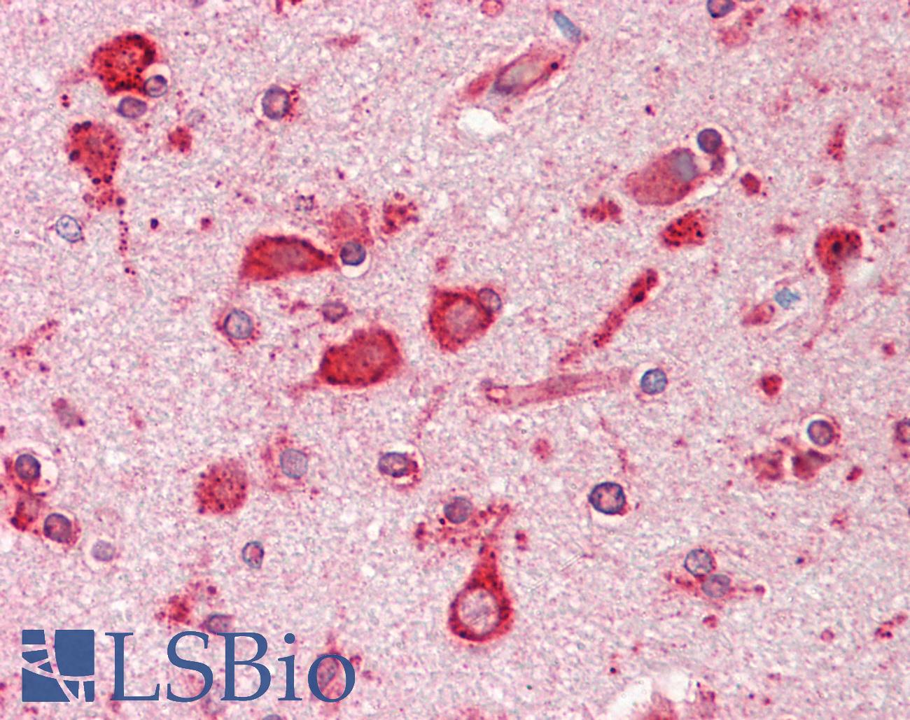 HSPA5 / GRP78 / BiP Antibody - Anti-HSPA5 / GRP78 / BIP antibody IHC staining of human brain, cortex. Immunohistochemistry of formalin-fixed, paraffin-embedded tissue after heat-induced antigen retrieval. Antibody dilution 1:100.
