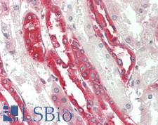 HSPA5 / GRP78 / BiP Antibody - Human Kidney: Formalin-Fixed, Paraffin-Embedded (FFPE)
