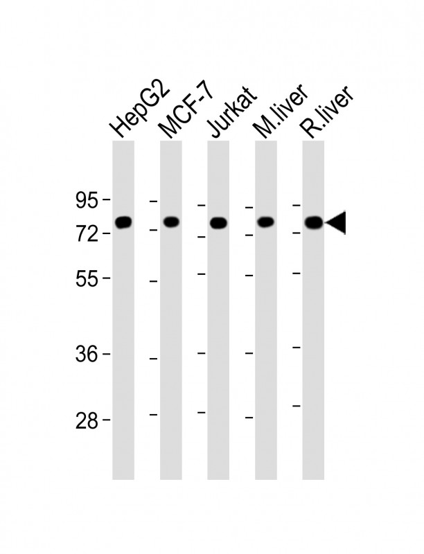 HSPA5 / GRP78 / BiP Antibody - All lanes: Anti-HSPA5 Antibody at 1:20000 dilution Lane 1: HepG2 whole cell lysate Lane 2: MCF-7 whole cell lysate Lane 3: Jurkat whole cell lysate Lane 4: mouse liver lysate Lane 5: rat liver lysate Lysates/proteins at 20 µg per lane. Secondary Goat Anti-mouse IgG, (H+L), Peroxidase conjugated at 1/10000 dilution. Predicted band size: 72 kDa Blocking/Dilution buffer: 5% NFDM/TBST.