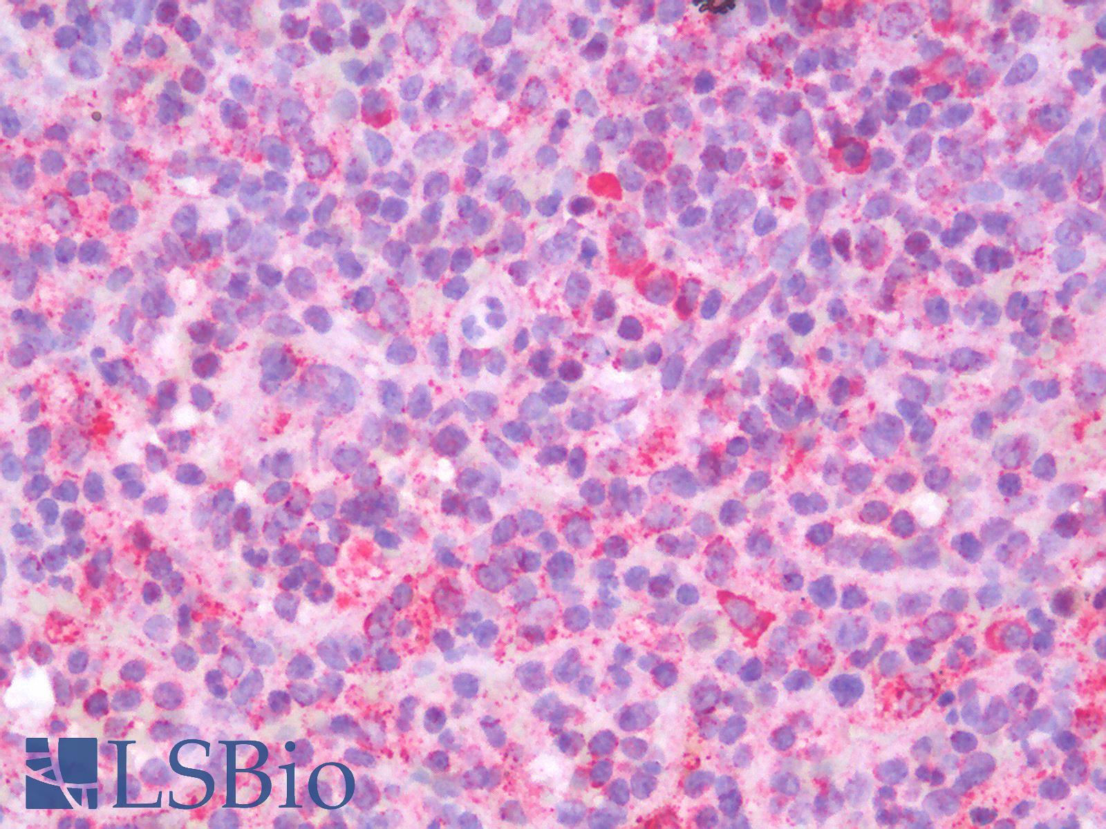 HSPA5 / GRP78 / BiP Antibody - Human Spleen: Formalin-Fixed, Paraffin-Embedded (FFPE)
