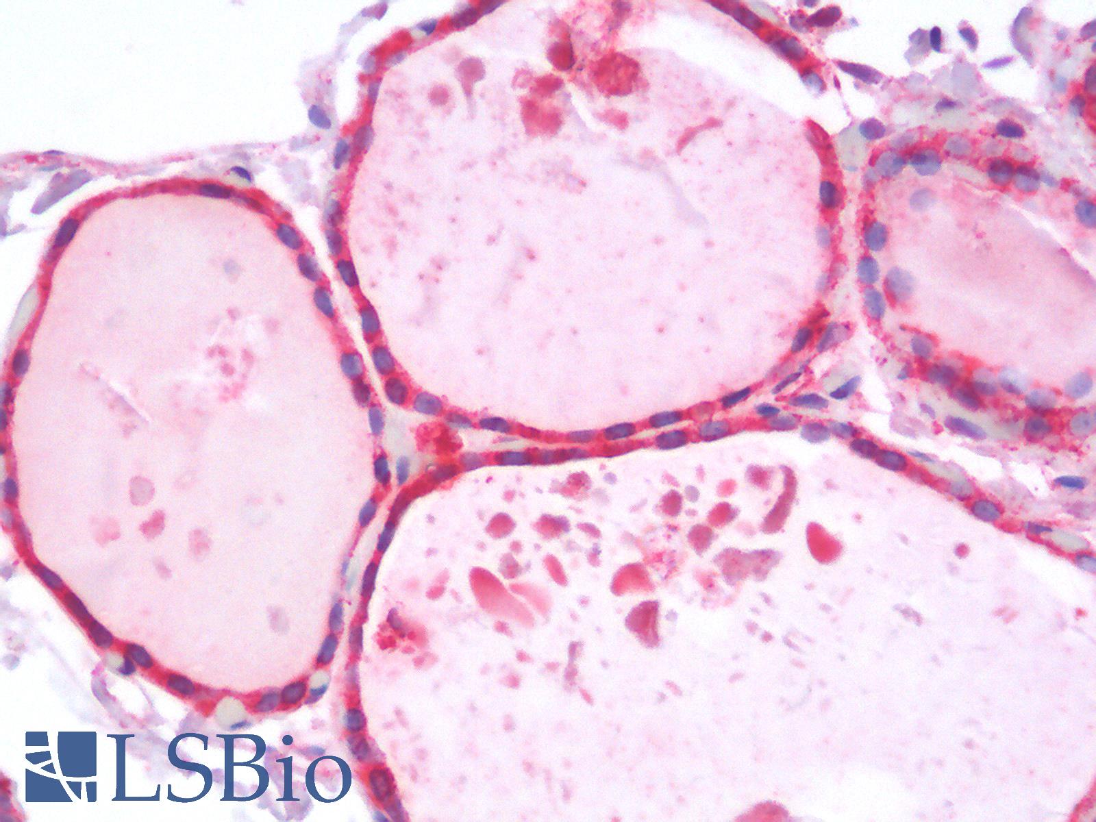 HSPA5 / GRP78 / BiP Antibody - Human Thyroid: Formalin-Fixed, Paraffin-Embedded (FFPE)