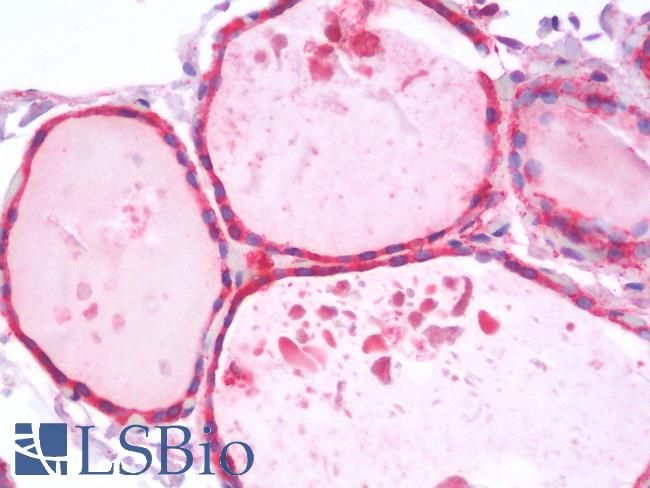 HSPA5 / GRP78 / BiP Antibody - Human Thyroid: Formalin-Fixed, Paraffin-Embedded (FFPE)